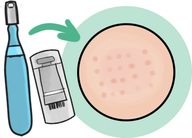 TOP 3 zabiegi kosmetyczne jesienią 5 1 1