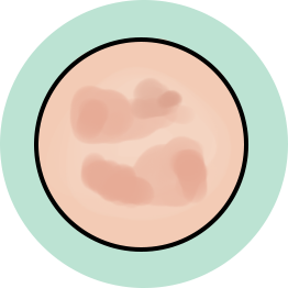 TOP 3 zabiegi kosmetyczne jesienią 8 3 2