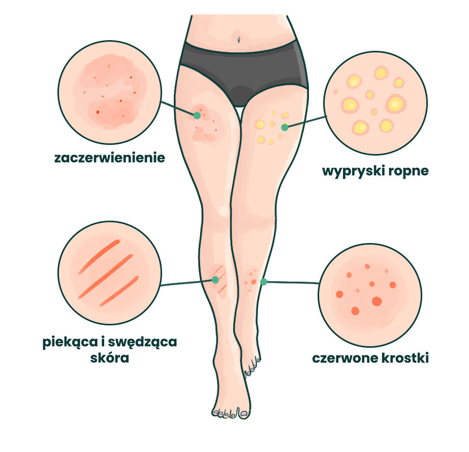 Jak prawidłowo się golić? Poradnik 2026 na idealne golenie się i gładką skórę bez podrażnień 2 depilacja1 edited